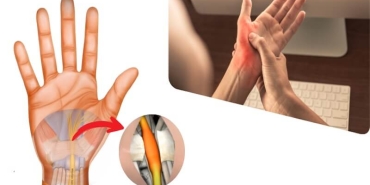 Ellerde Uyuşma Şikayeti Olanların Bilmesi Gerekenler