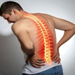 Vertebroplasti Ameliyatı: Omurga Kırıklarında Modern Tedavi Yaklaşımı