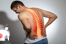 Vertebroplasti Ameliyatı: Omurga Kırıklarında Modern Tedavi Yaklaşımı